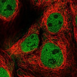 FAM222B Antibody, Novus Biologicals 0.1mL; Unlabeled:Antibodies, Polyclonal